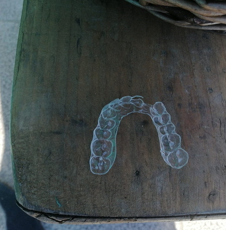 Found Retainer outside Happy Pear 16MAR21 Danah Nic Amhlai